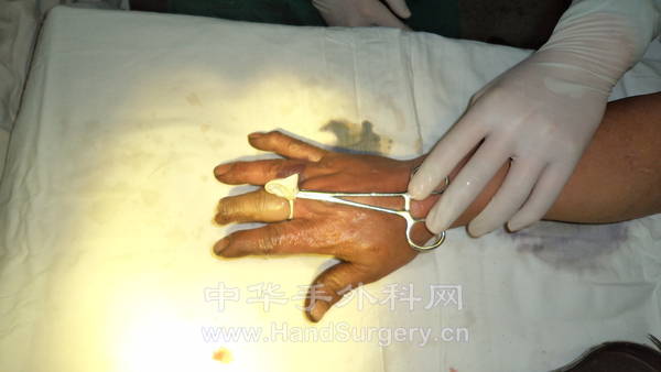 术前