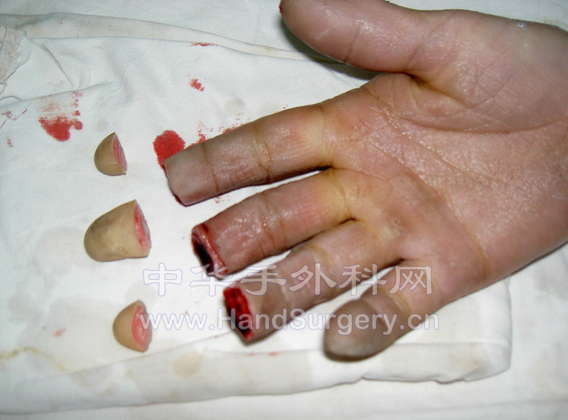 PICT1008.JPG