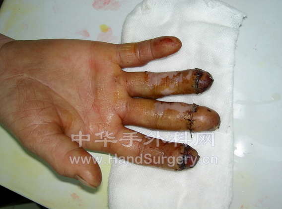 PICT1052.JPG