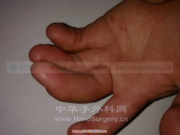 20110305036.jpg