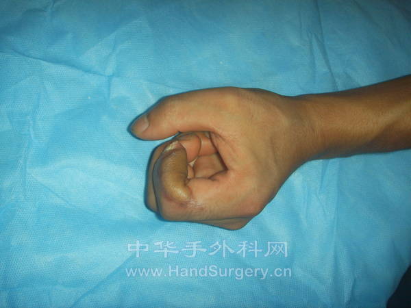 五个月后外形功能