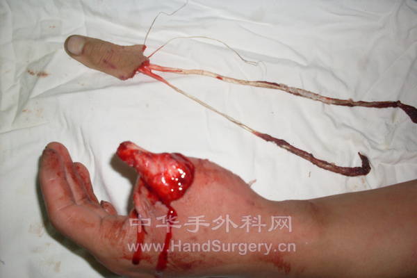 王闯 48616 (1).JPG