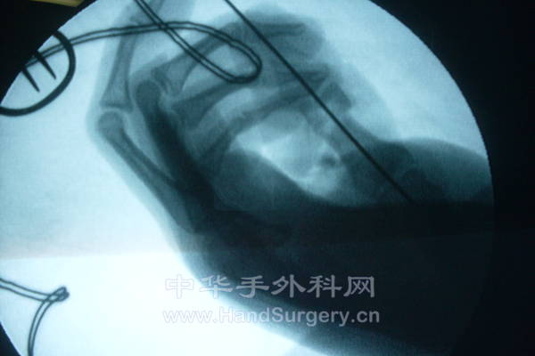 王闯 48616 (2).JPG