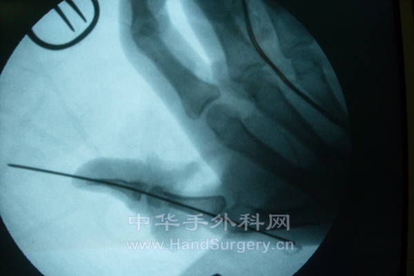 王闯 48616 (3).JPG