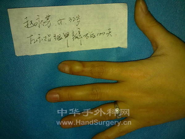旋转 20130204390.jpg