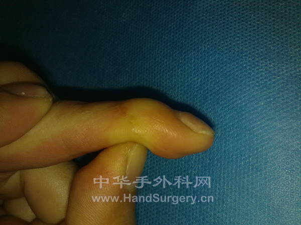 旋转 20130204393.jpg