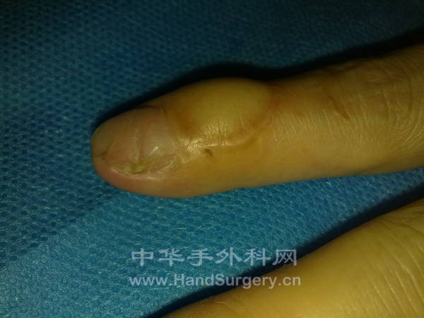 旋转 20130204391.jpg