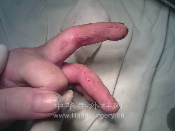20130128362.jpg
