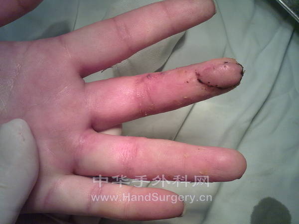 20130128363.jpg