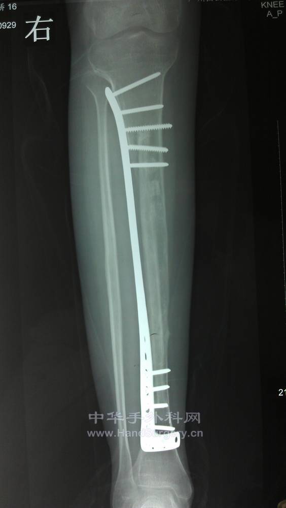 IMAG0177.jpg