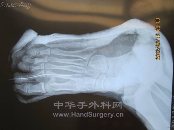 照片 044.jpg