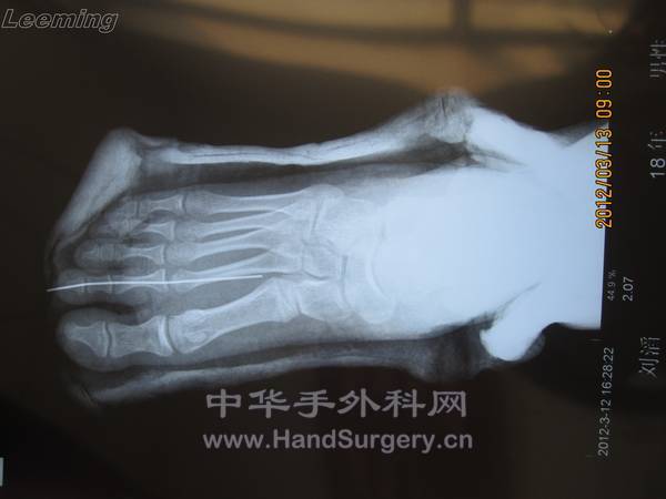 照片 045.jpg