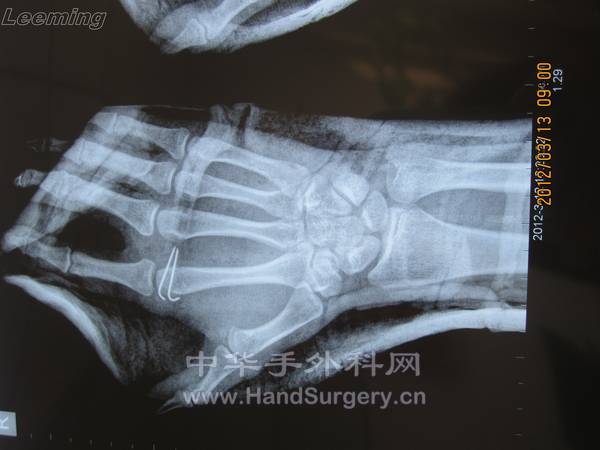 照片 046.jpg