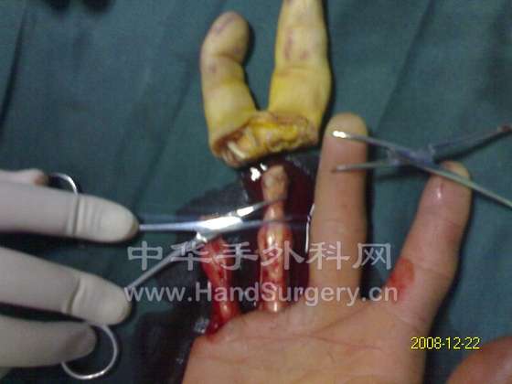 D22122008001.jpg