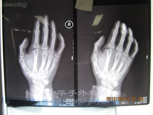照片 035.jpg