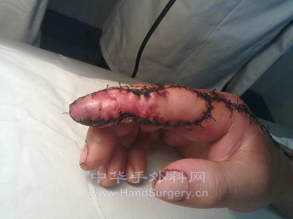 旋转 20130126340.jpg