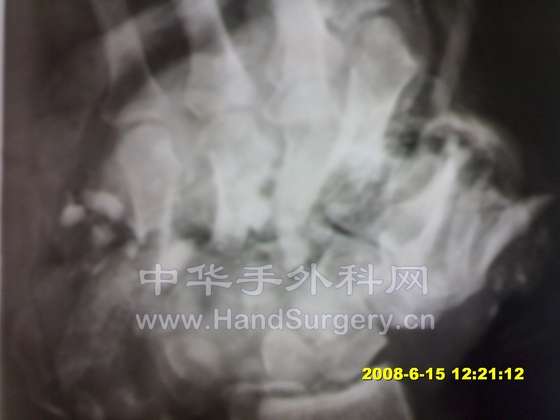 DD15062008519.jpg