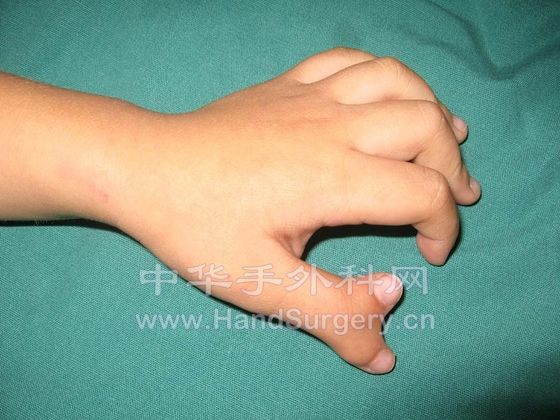 两岁多男性
