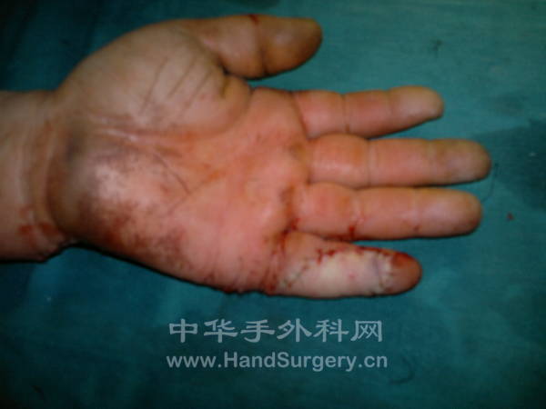 20130125315.jpg