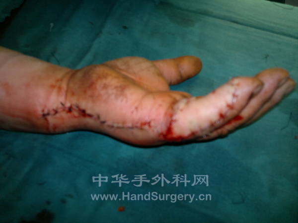 20130125318.jpg