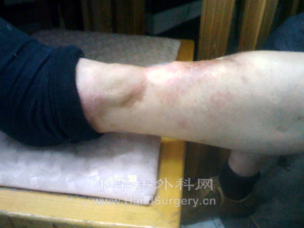 IMG_20130313_124559.jpg