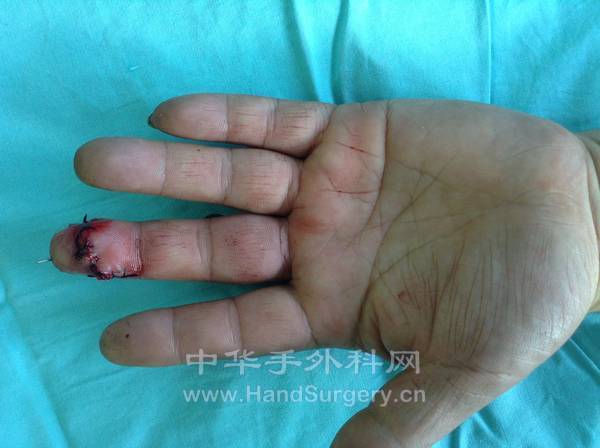 Fuliang Ding作品