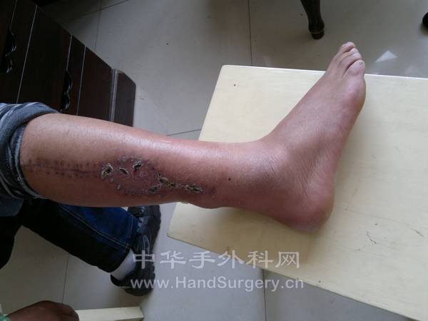 20130329360.jpg
