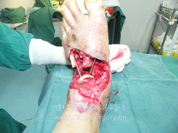 DSCF9670.JPG