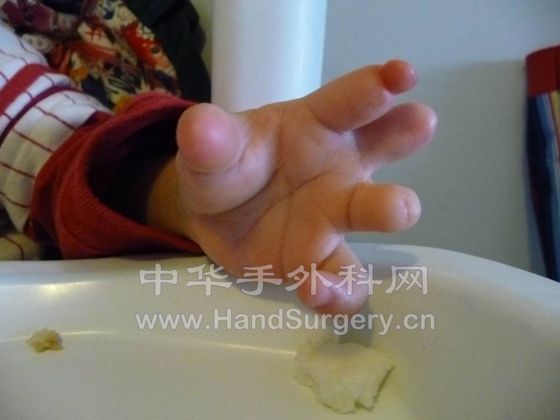 Hand-L-02.JPG