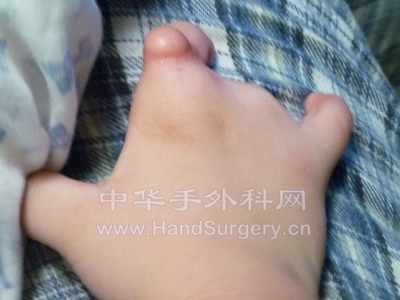 Hand-R-04.JPG