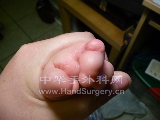 Hand-R-01.JPG