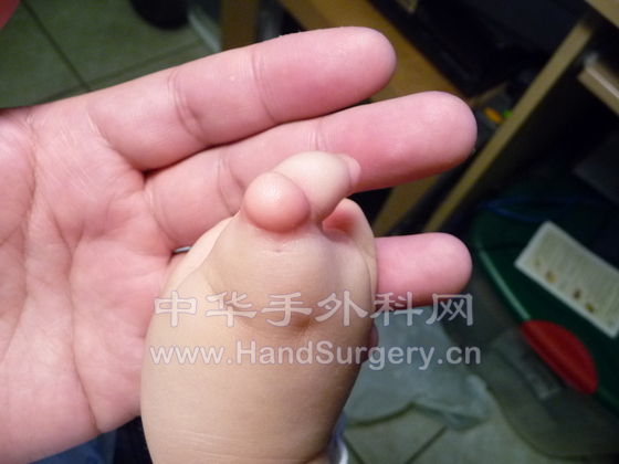 Hand-R-02.JPG