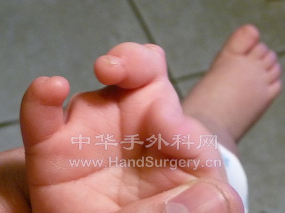 Hand-R-03.JPG