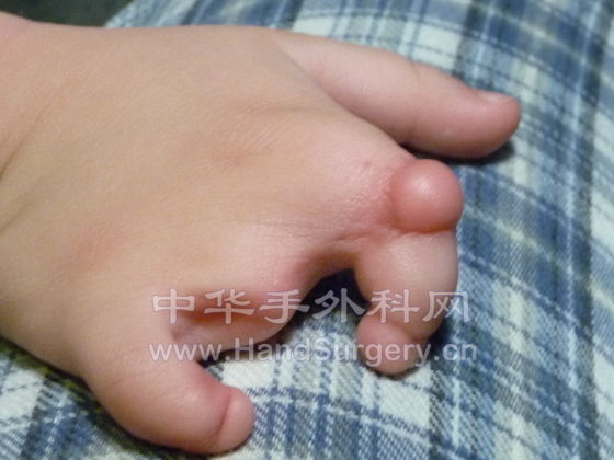 Hand-R-05.JPG