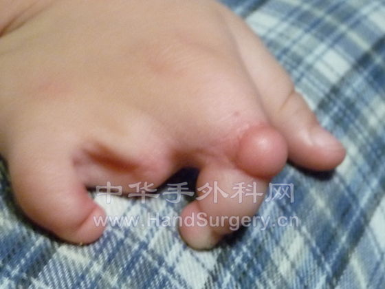 Hand-R-06.JPG