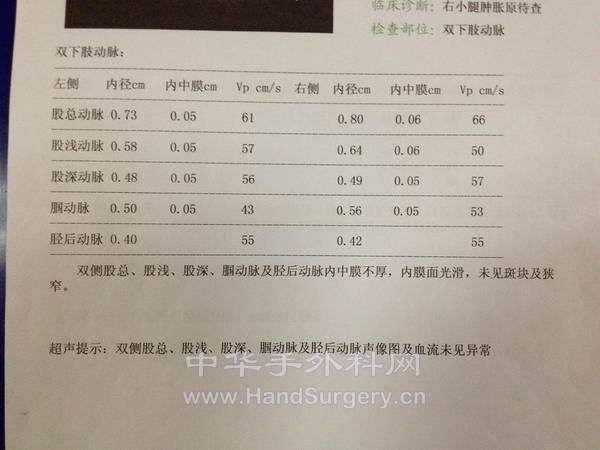 下肢动静脉血管彩超