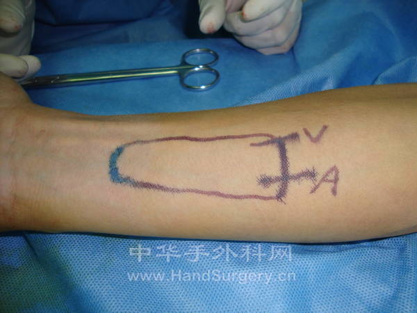 祝年明 男 (6).JPG