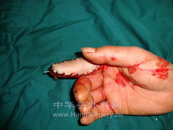 祝年明 男 (11).JPG