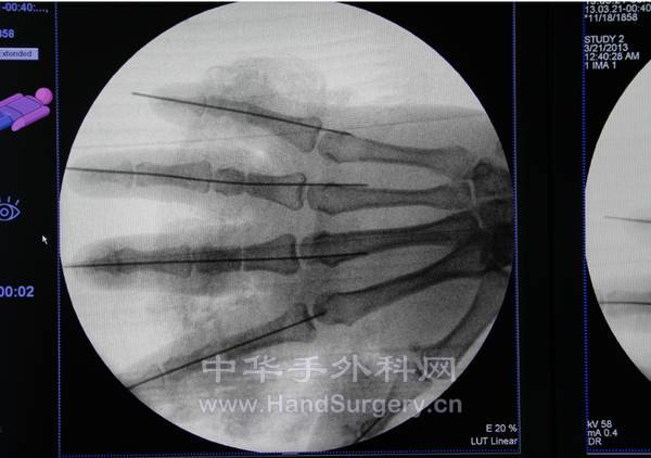 QQ截图20130322002505.png