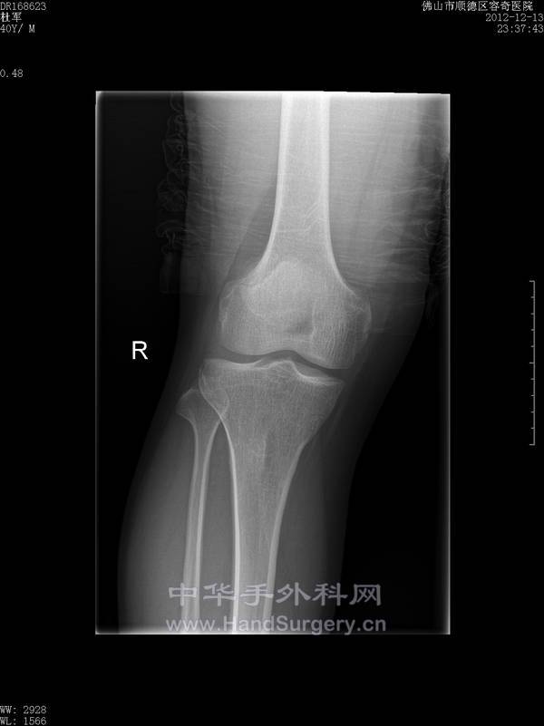 请留意右侧外上方向