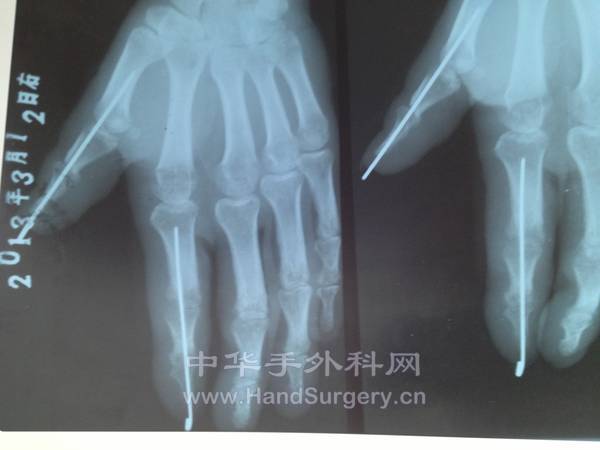 照片 023.jpg