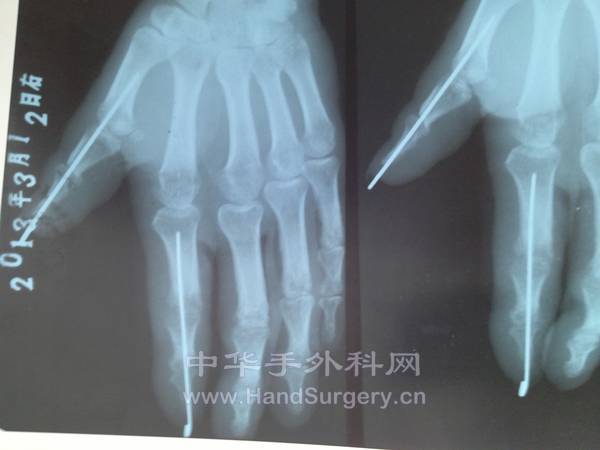 照片 024.jpg