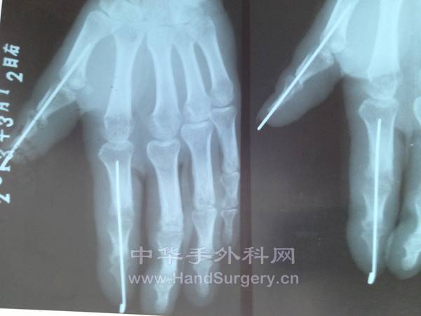 照片 025.jpg