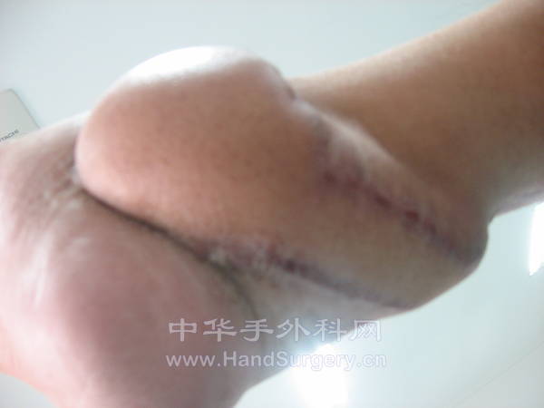 起步 057.jpg