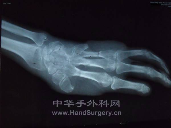 20130408.JPG