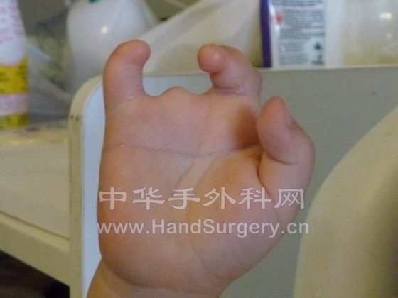 Hand-R-07.JPG