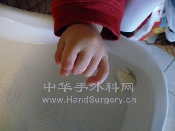 Hand-L-01.JPG