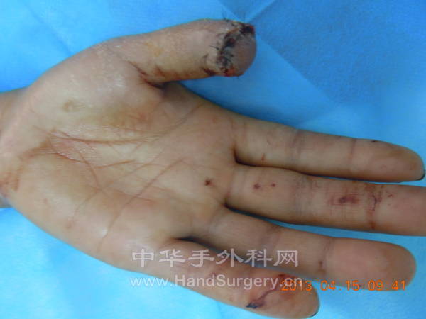 DSCN9646.JPG