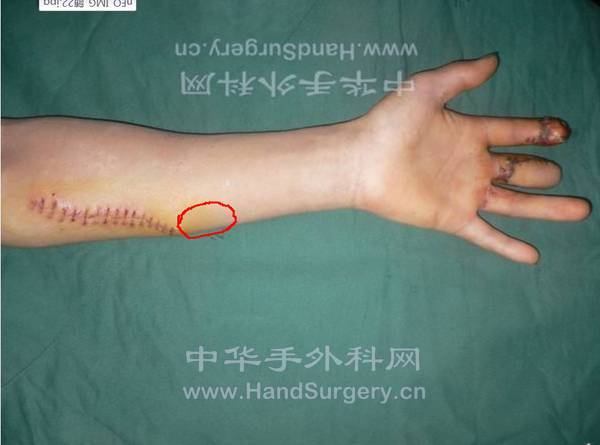 YY截图20130512200310.png