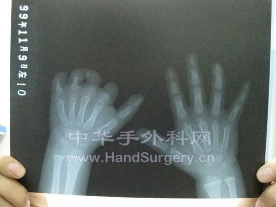 手照片.jpg
